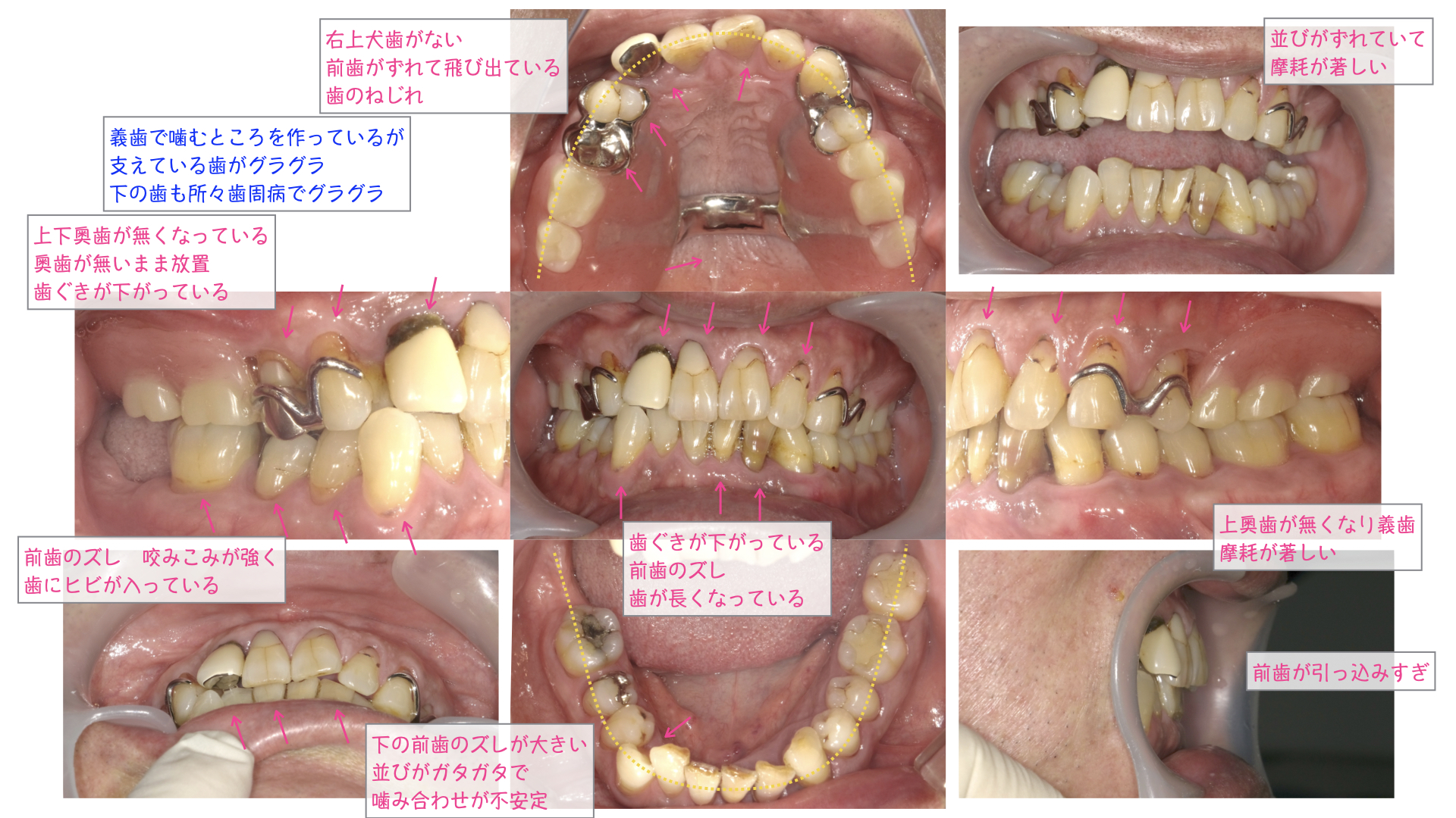 自分の歯の数知ってますか？ | 我孫子の歯医者さん｜なかむら歯科我孫子の歯医者さん｜なかむら歯科